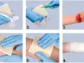 Instrukcja: opatrunek hemostatyczny jak używać. Wyjmij, przygotuj, przyłóż do rany, dociśnij, zabezpiecz bandażem.