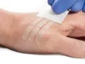 Ręka z kilkoma **stripy na ranę** przyklejonymi przez osobę w niebieskiej rękawiczce.