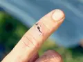 Palec z raną do szycia, czarne nici chirurgiczne zszywają skórę.
