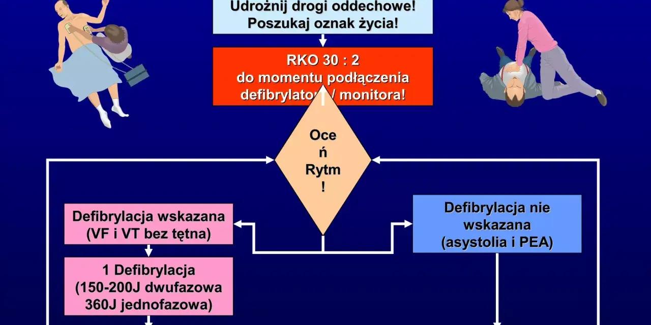 Algorytm ALS: nie reaguje? Udrożnij drogi oddechowe, poszukaj oznak życia. RKO 30:2 do momentu podłączenia defibrylatora. To kluczowe w pierwszej pomocy.