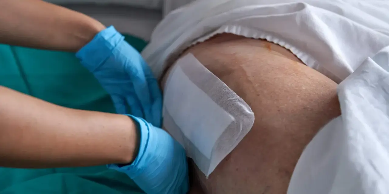 Rękawiczki chirurgiczne zakładane na udo pacjenta, przygotowanie do zastosowania nowoczesnych metod leczenia ran przewlekłych.