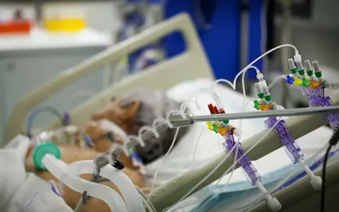 Pacjent wentylowany mechanicznie, podłączony do aparatury medycznej. Widać rurki intubacyjne i kroplówki.