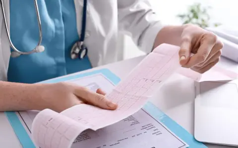 Lekarz analizuje wydruk EKG, pokazujący zapis pracy serca. To kluczowy element, jak się robi EKG i interpretuje wyniki.