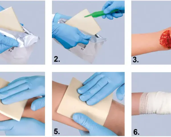 Instrukcja: opatrunek hemostatyczny jak używać. Wyjmij, przygotuj, przyłóż do rany, dociśnij, zabezpiecz bandażem.