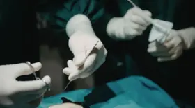 Chirurgiczne rękawiczki i narzędzia, przygotowanie do zabiegu. Znieczulenie miejscowe zapewnia komfort pacjentowi.